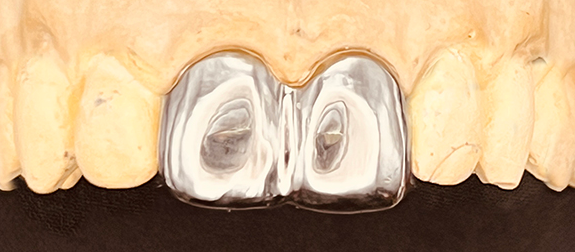 Stacks Image 174