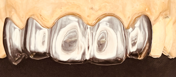 Stacks Image 174